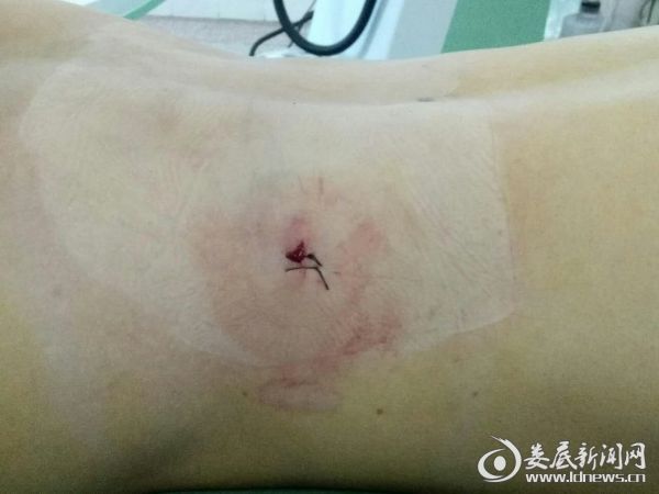 QQ图片20170811190406