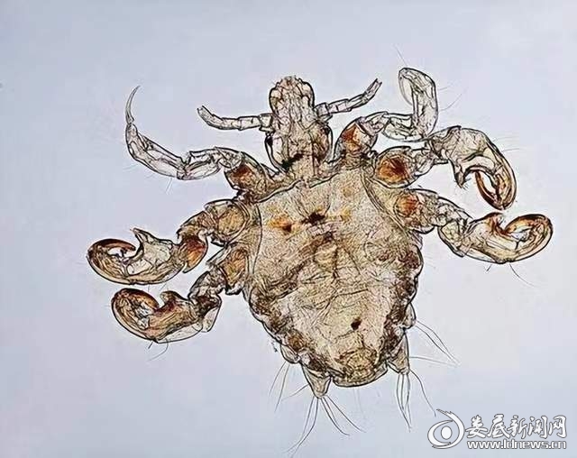 ▲形似螃蟹的阴虱